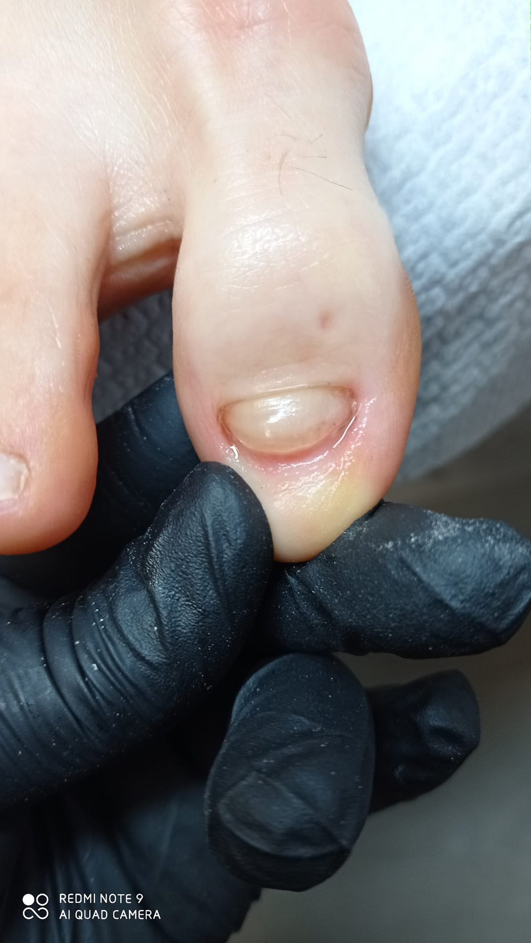 Rezultat tratament medical 10