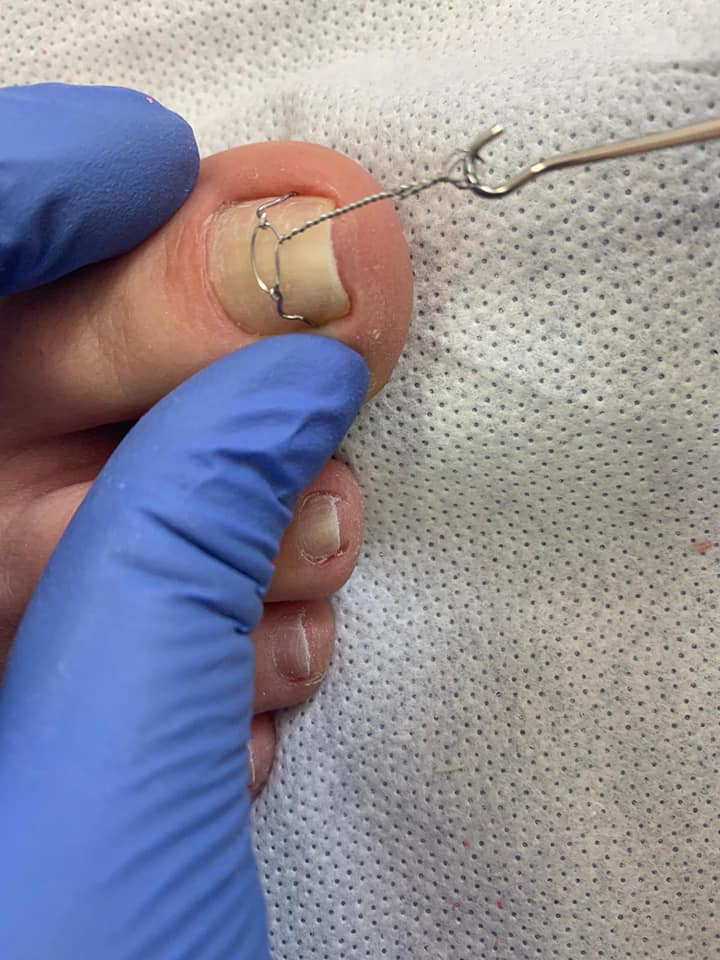 Rezultat tratament medical 13