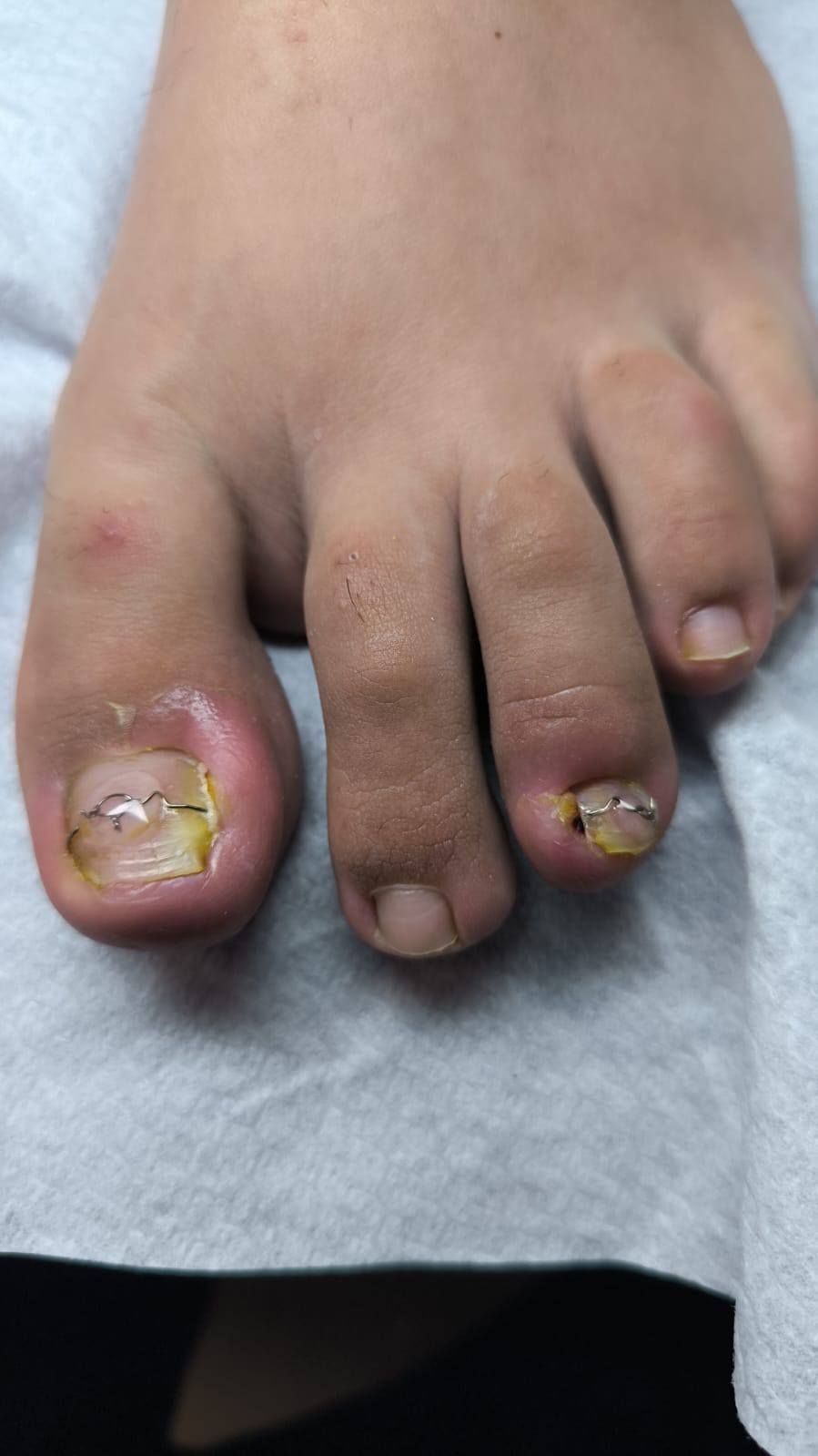 Rezultat tratament medical 6